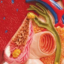 膽結(jié)石一定要開刀嗎?