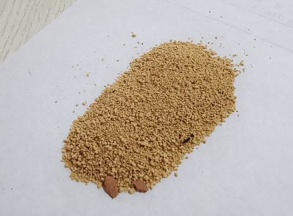 膽結(jié)石患者如何洗大便來觀察排石情況