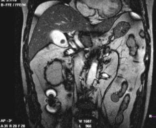 đҽY(ji)ʯCTӰF(xin)