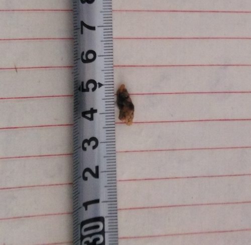 ^ָᘯίݔĩ˽Y(ji)ʯ