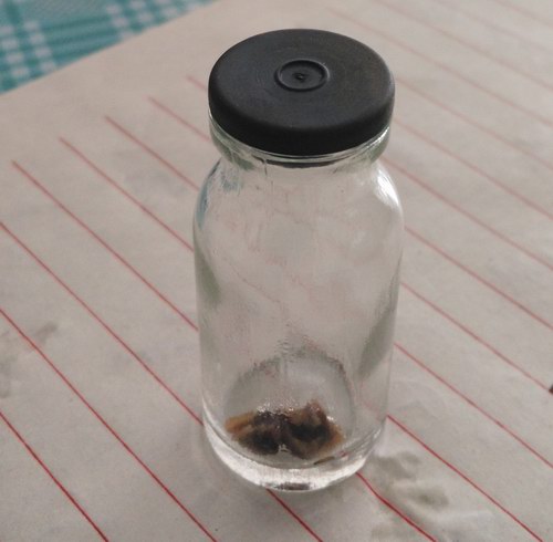 ^ָᘯίݔĩ˽Y(ji)ʯ