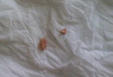 ʯɴκָᘯµĽY(ji)ʯ